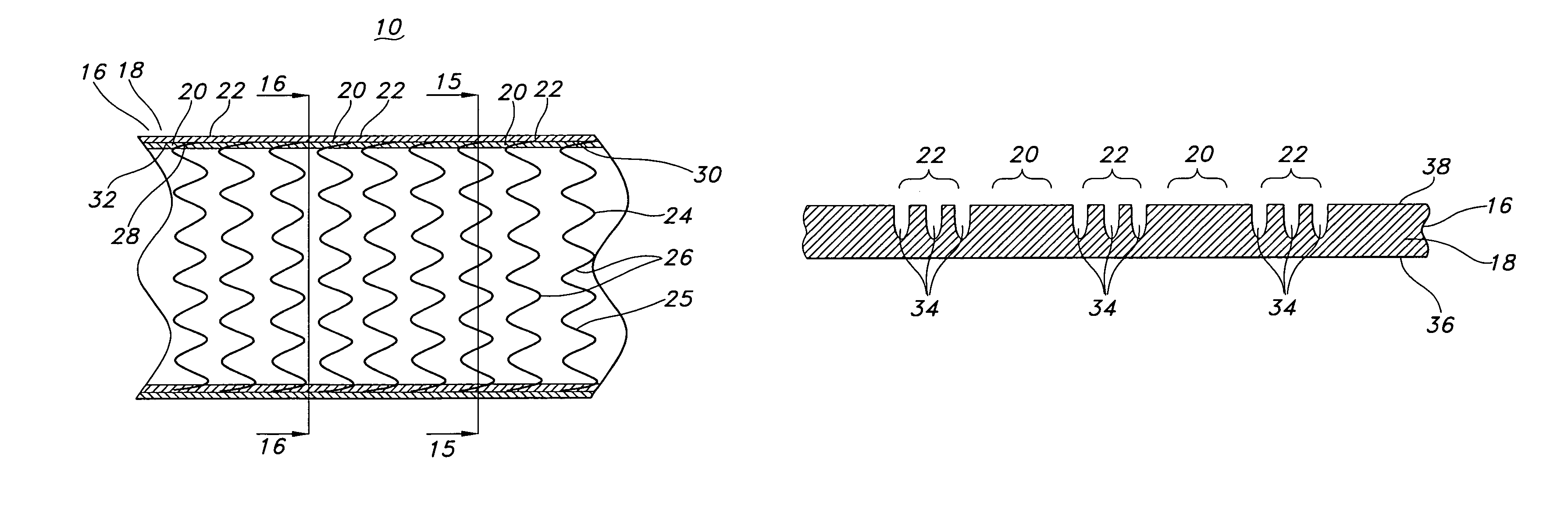 Stent-graft having flexible geometries and methods of producing the same