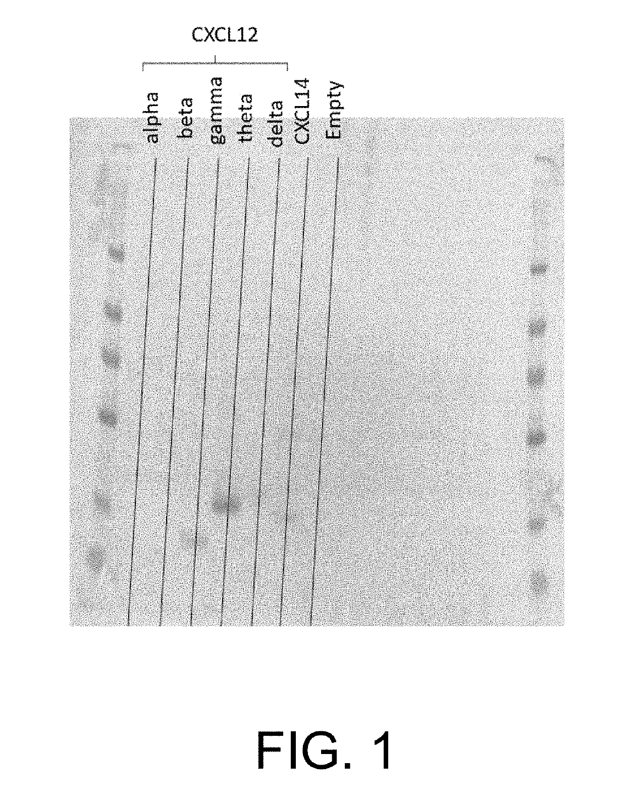 Treating diabetes with genetically modified beta cells