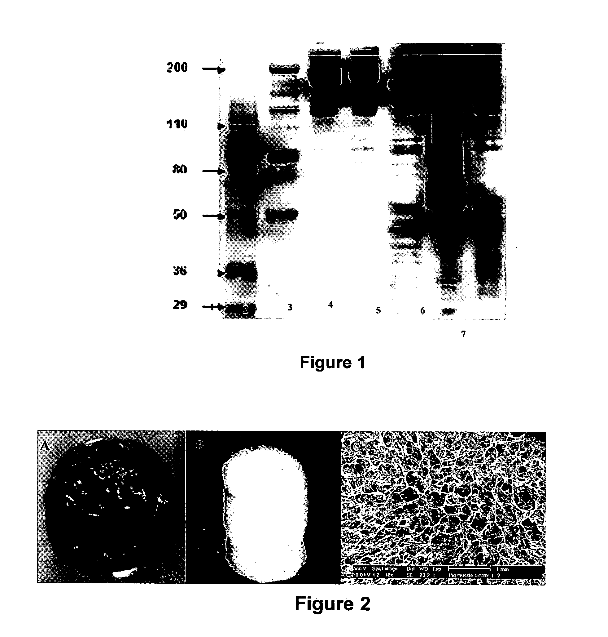 Tissue material and matrix