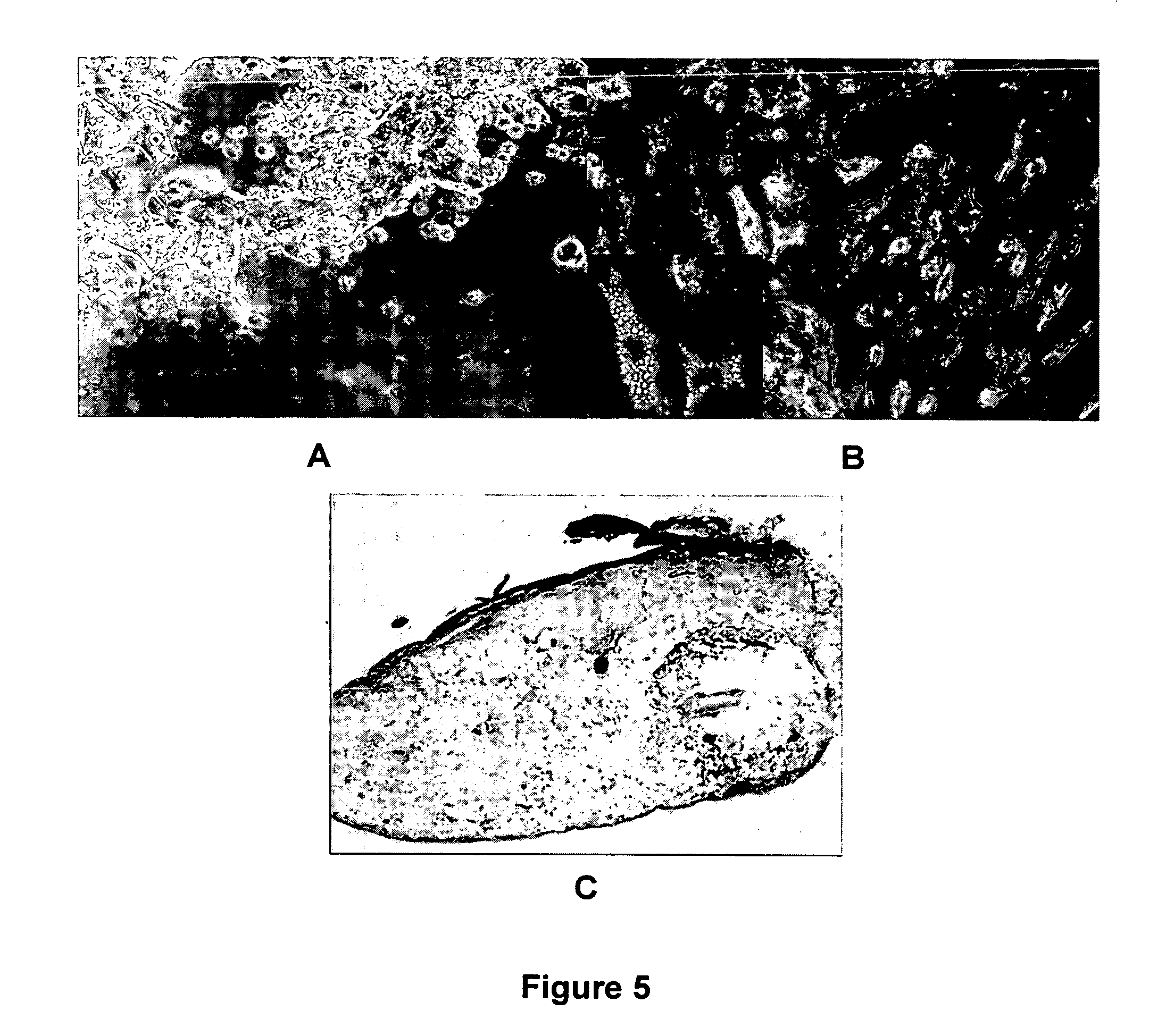 Tissue material and matrix