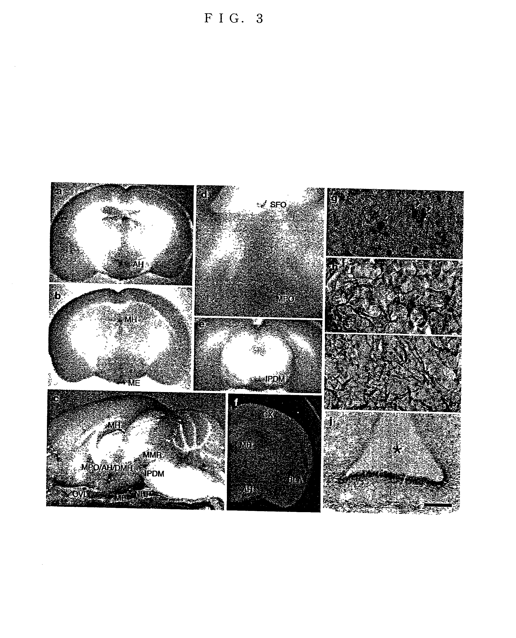 Nav2 channel gene-deficient non-human animals