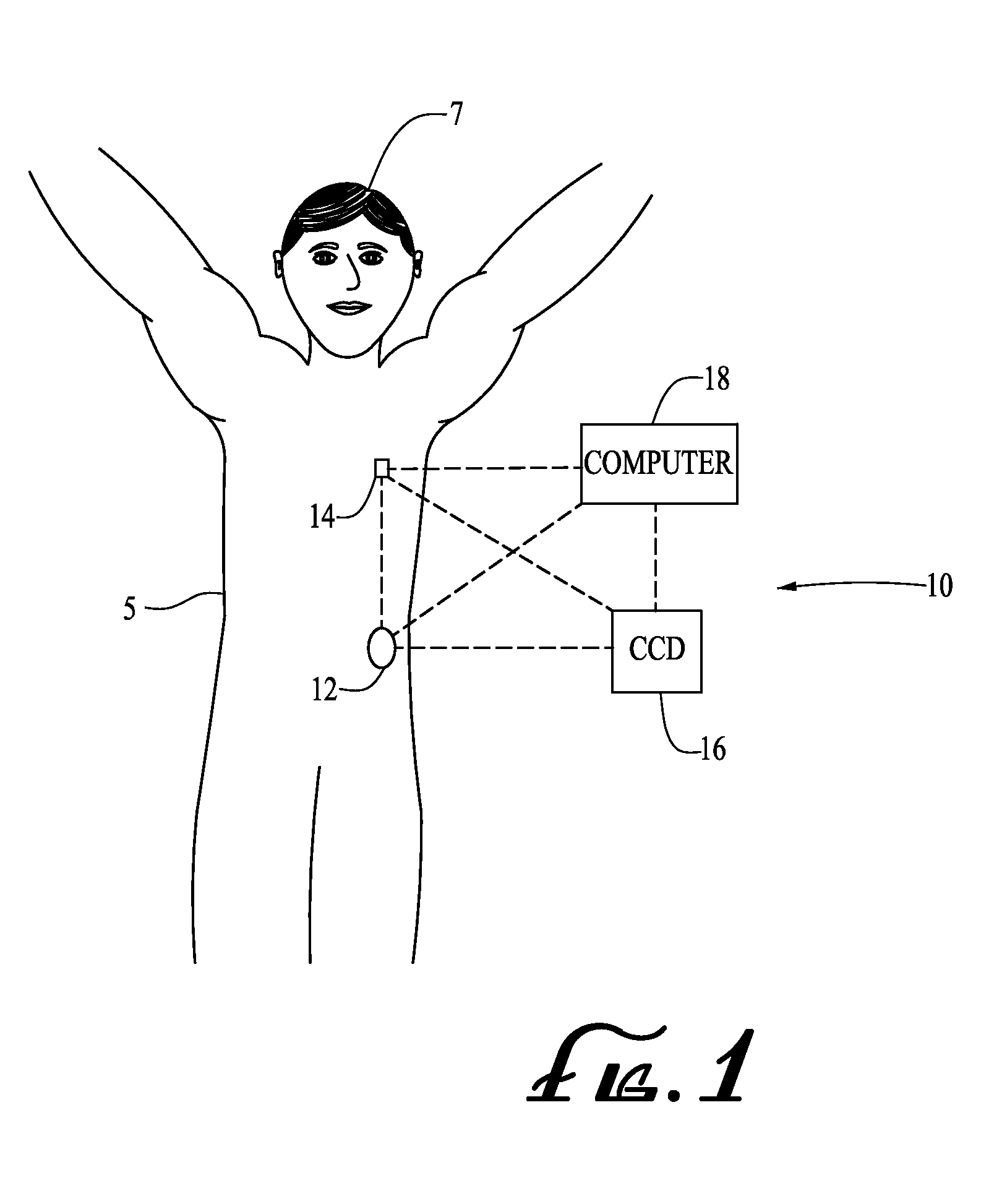 Engagement and sensing systems and methods