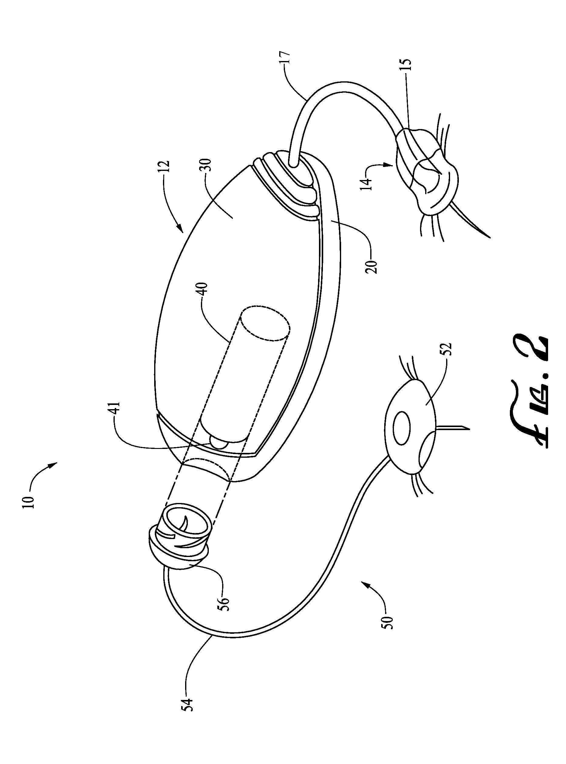 Engagement and sensing systems and methods