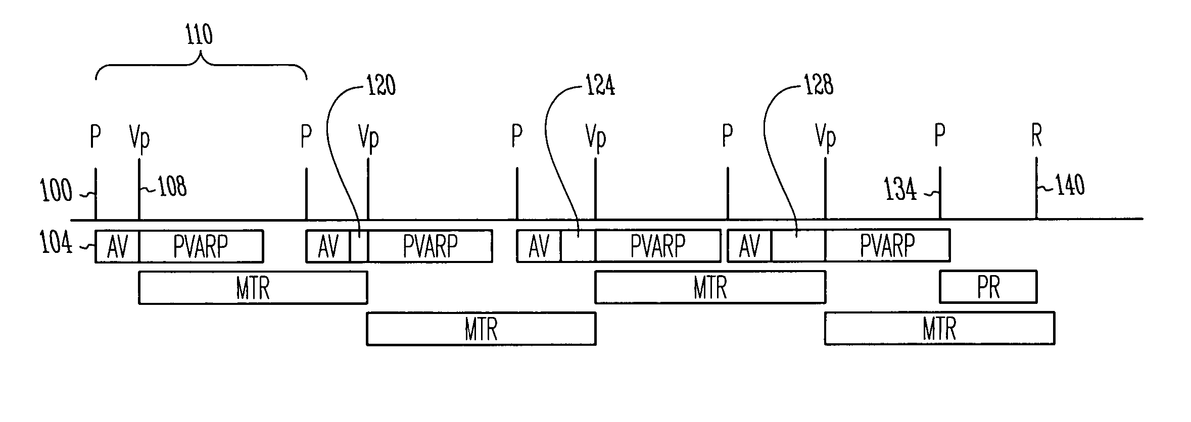 Cardiac rhythm management system with maximum tracking rate (MTR) hysteresis