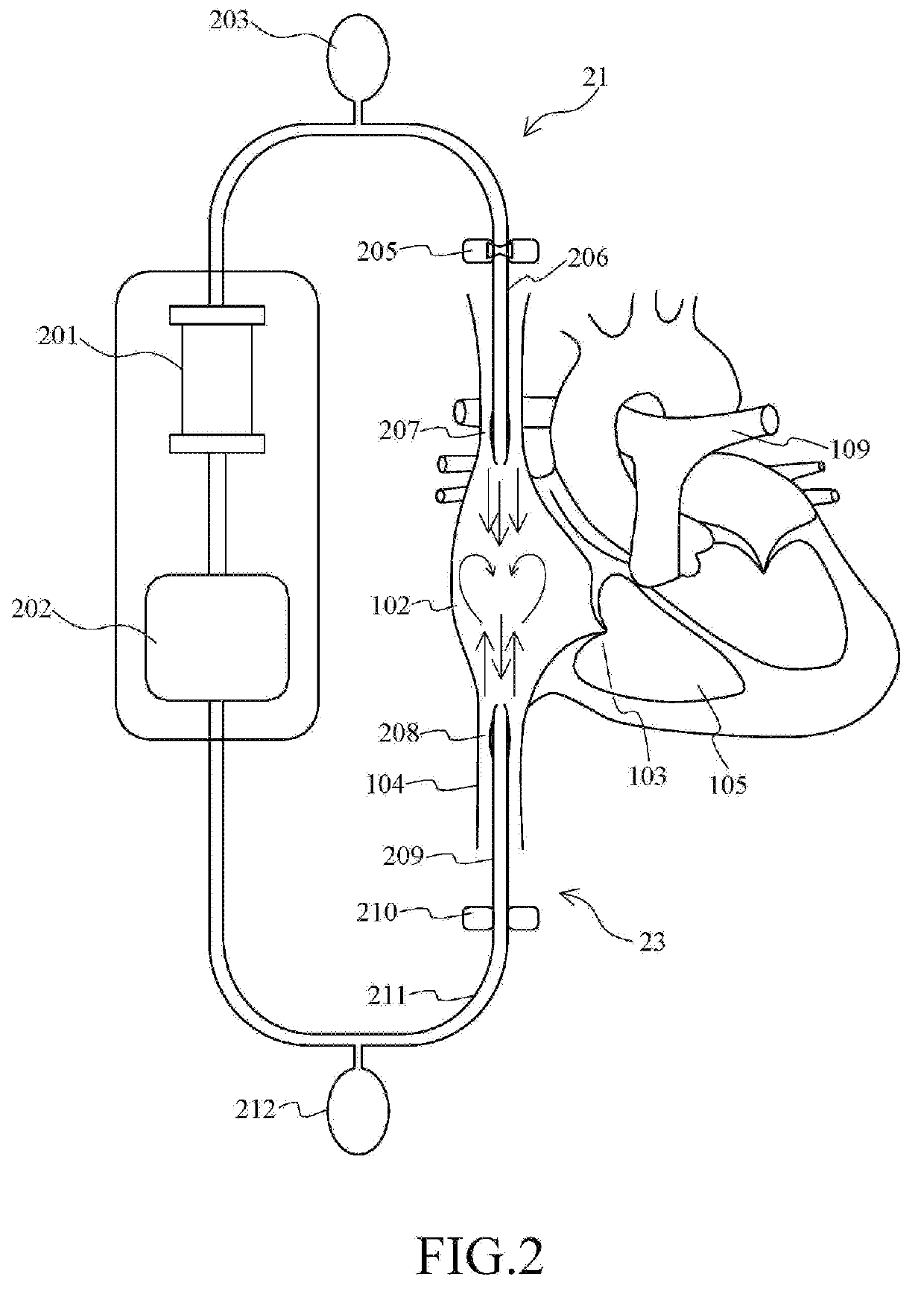 Extracorporeal life support system