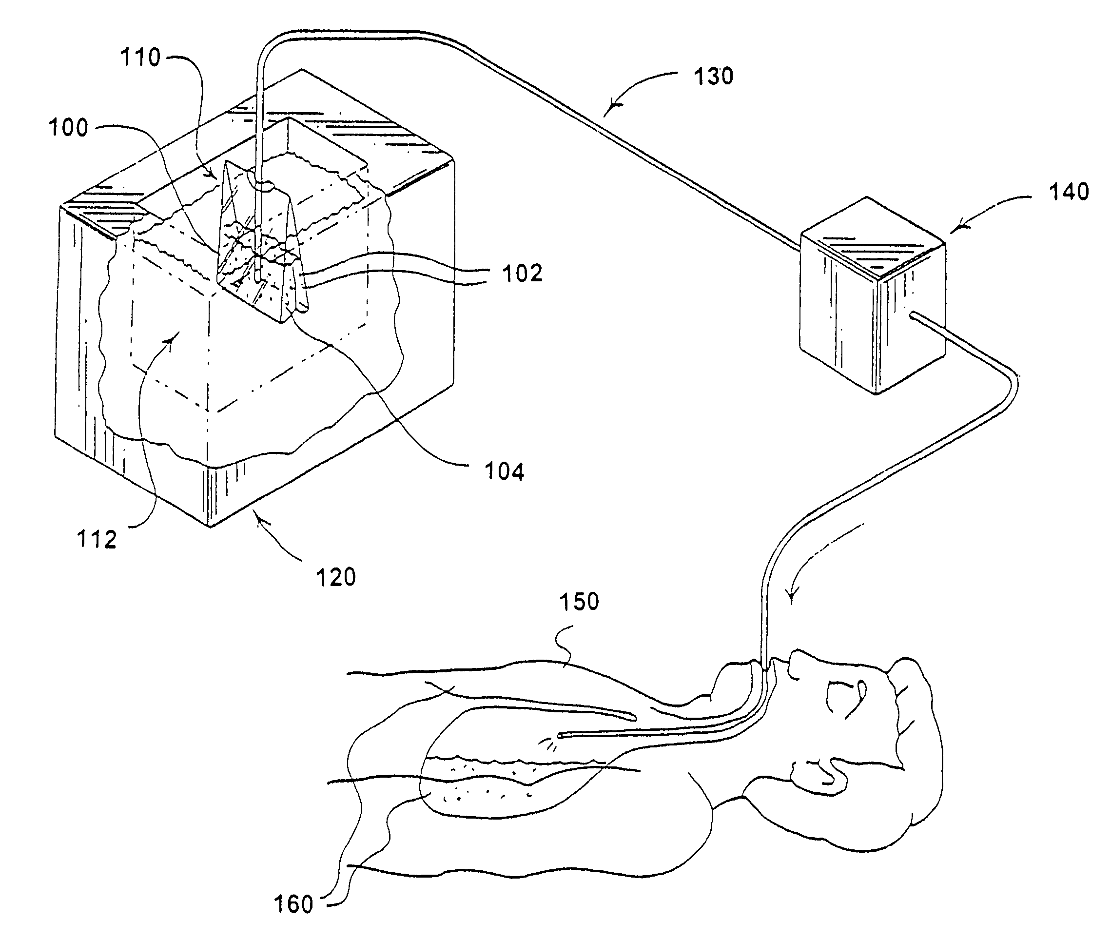 Method for inducing hypothermia