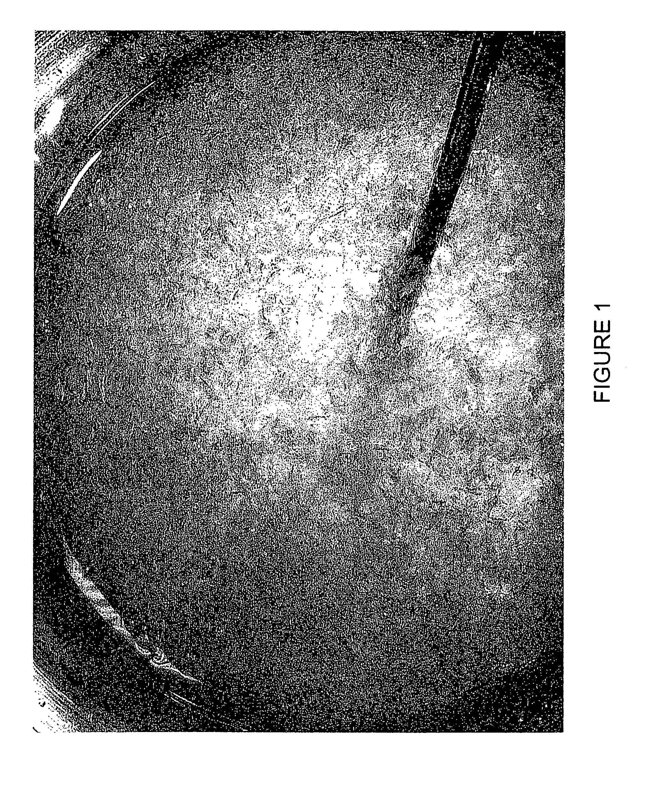 Method for inducing hypothermia