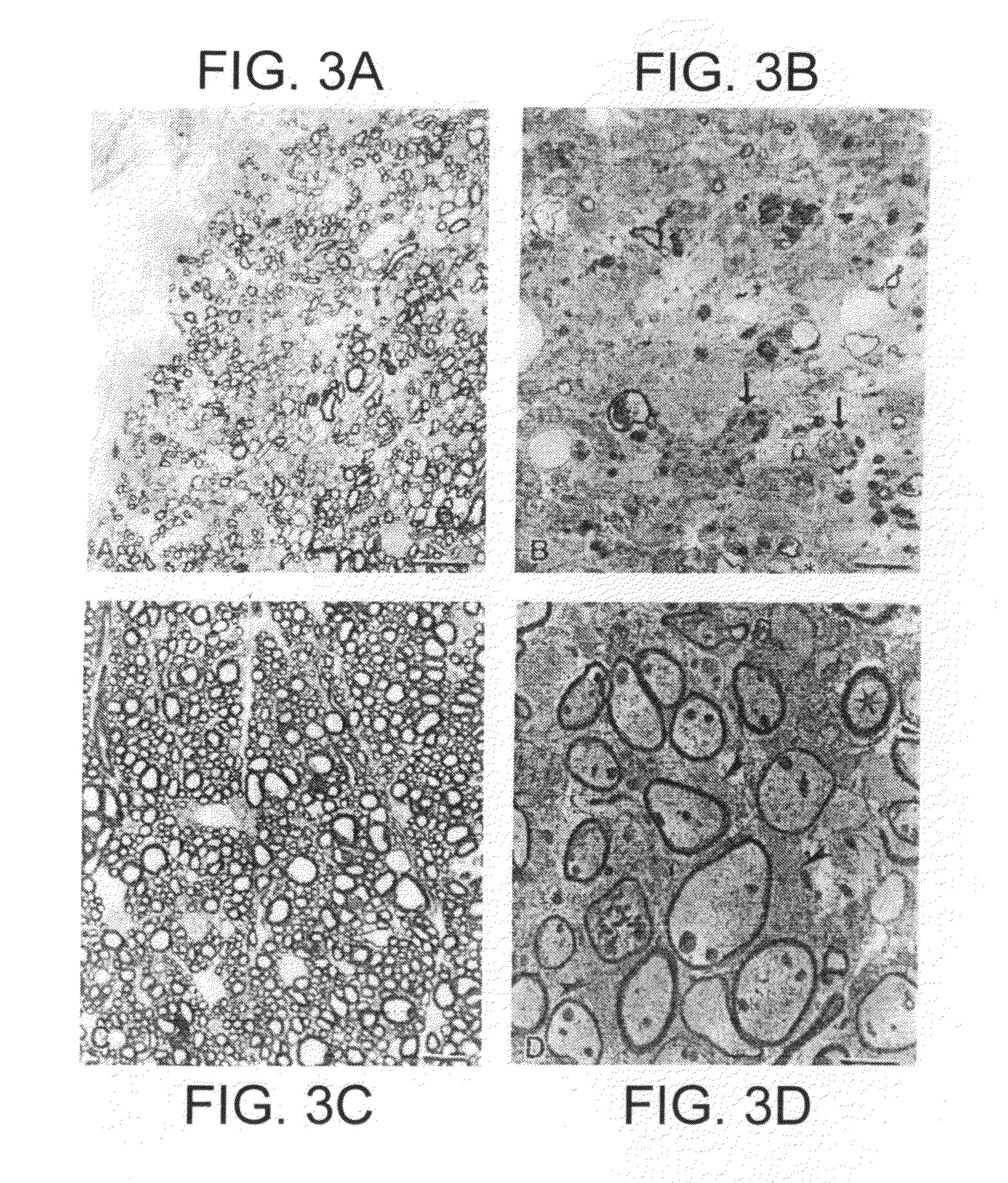 Human IgM antibodies, and diagnostic and therapeutic uses thereof particularly in the central nervous system