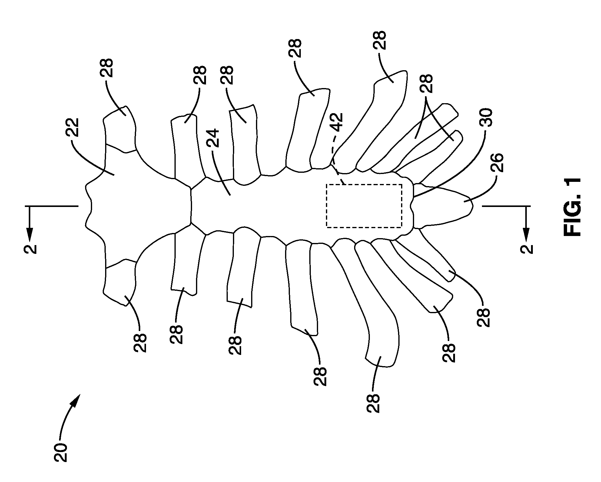 Apparatus and method for magnetic alteration of anatomical features