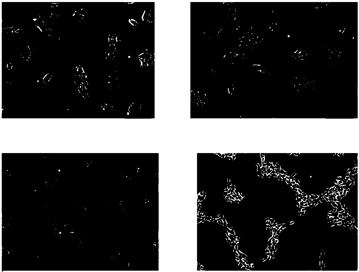 Method for preparing vascular endothelial cells and kit specially used for method