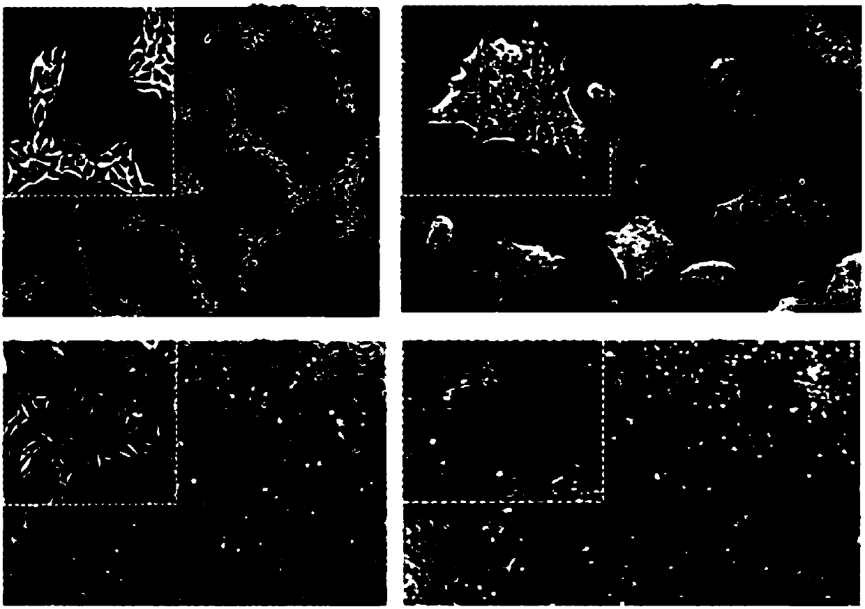 Method for preparing vascular endothelial cells and kit specially used for method