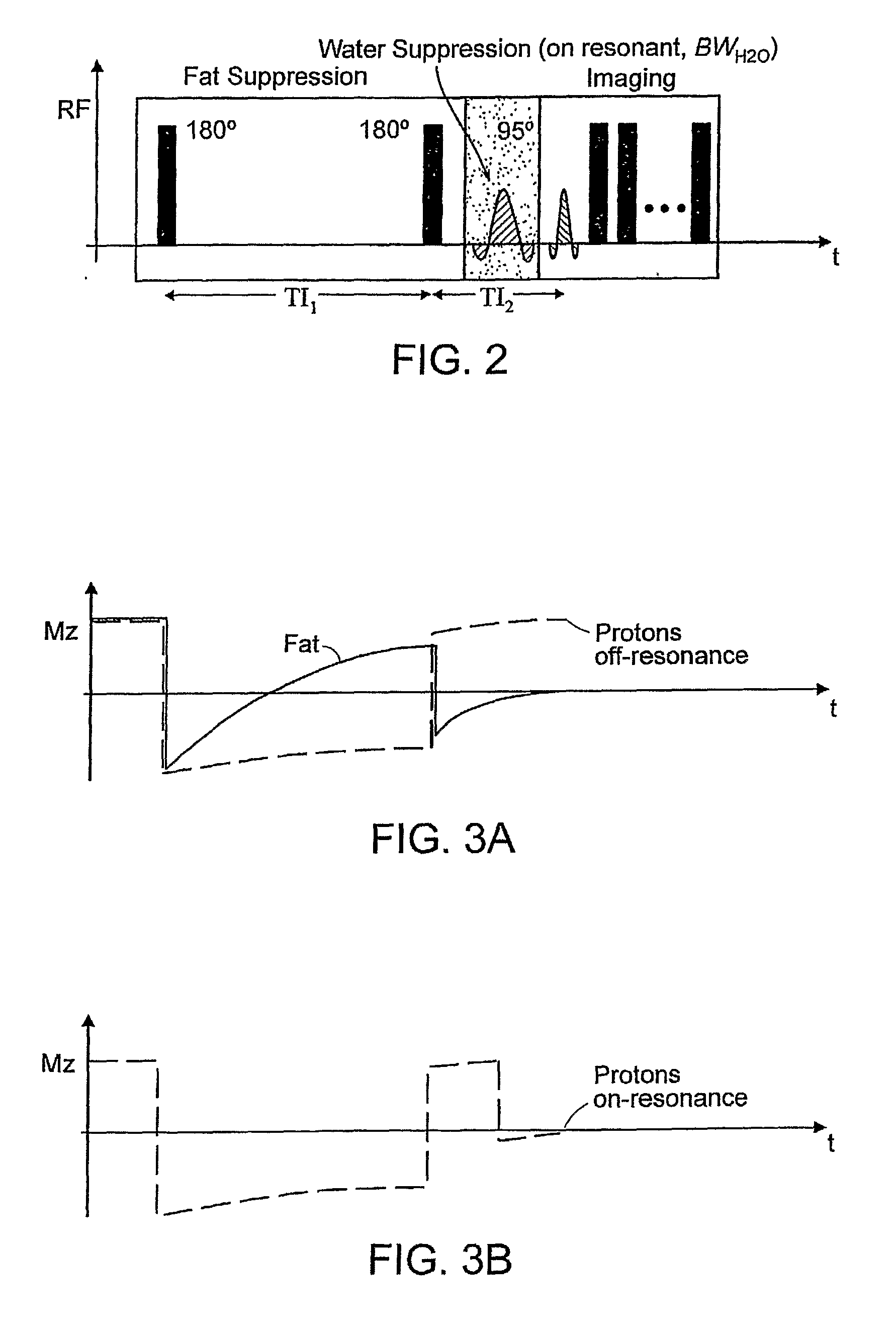 Method for magnetic resonance imaging using inversion recovery with on-resonant water suppression including mri systems and software embodying same