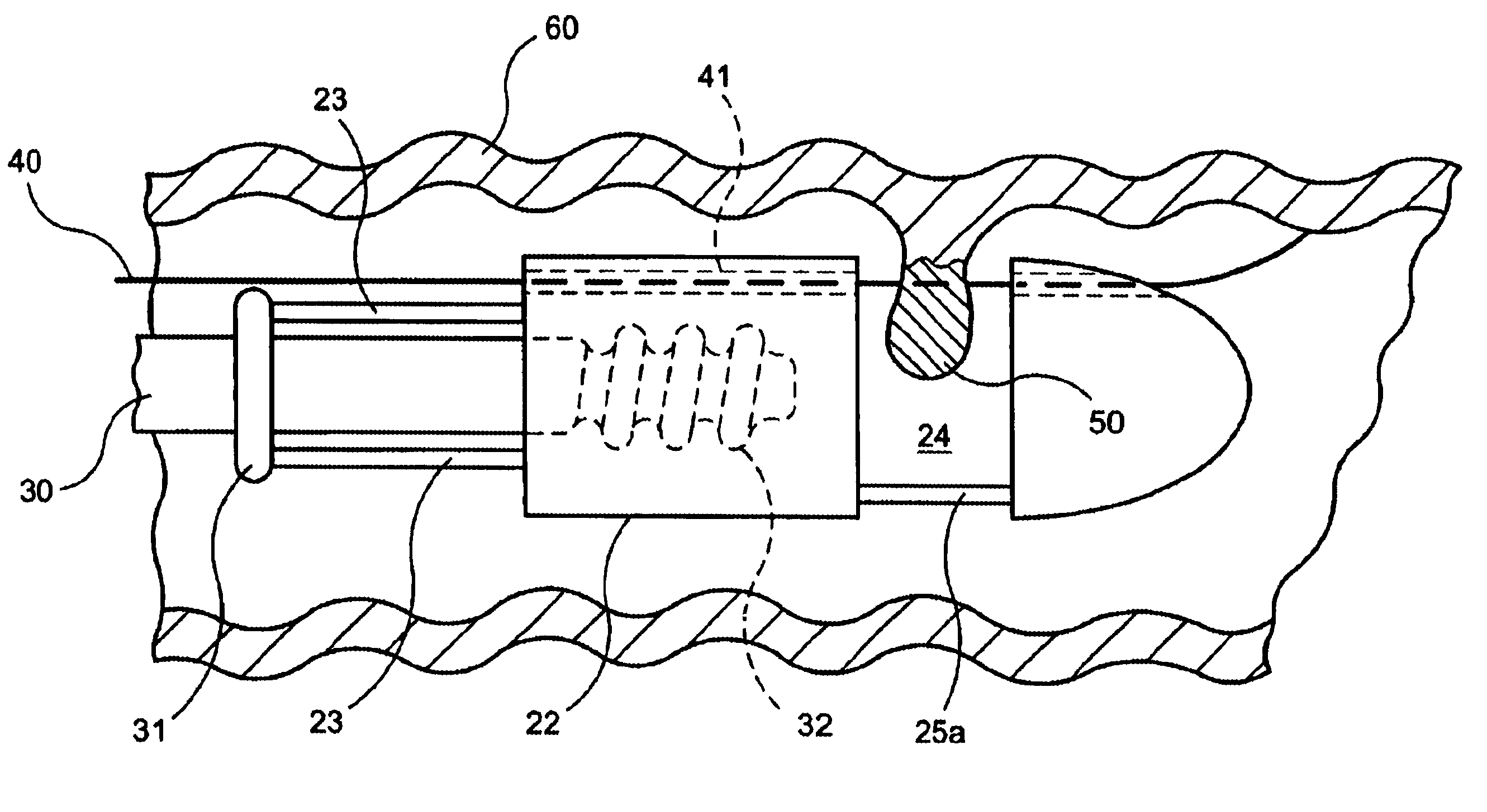 Endoscopic resection devices