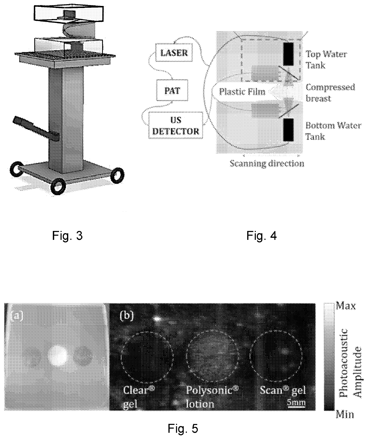 Photoacoustic breast imaging system and method