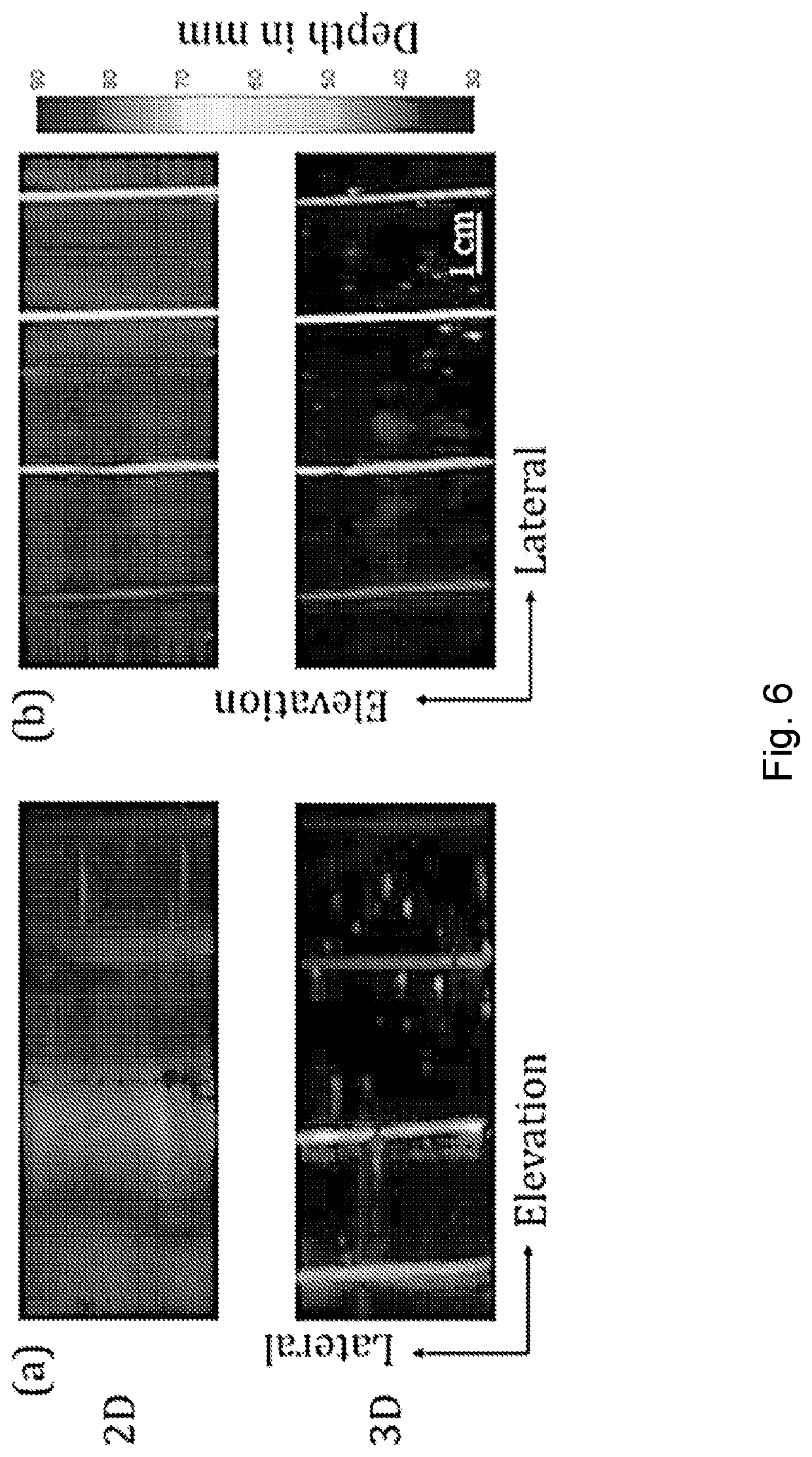 Photoacoustic breast imaging system and method