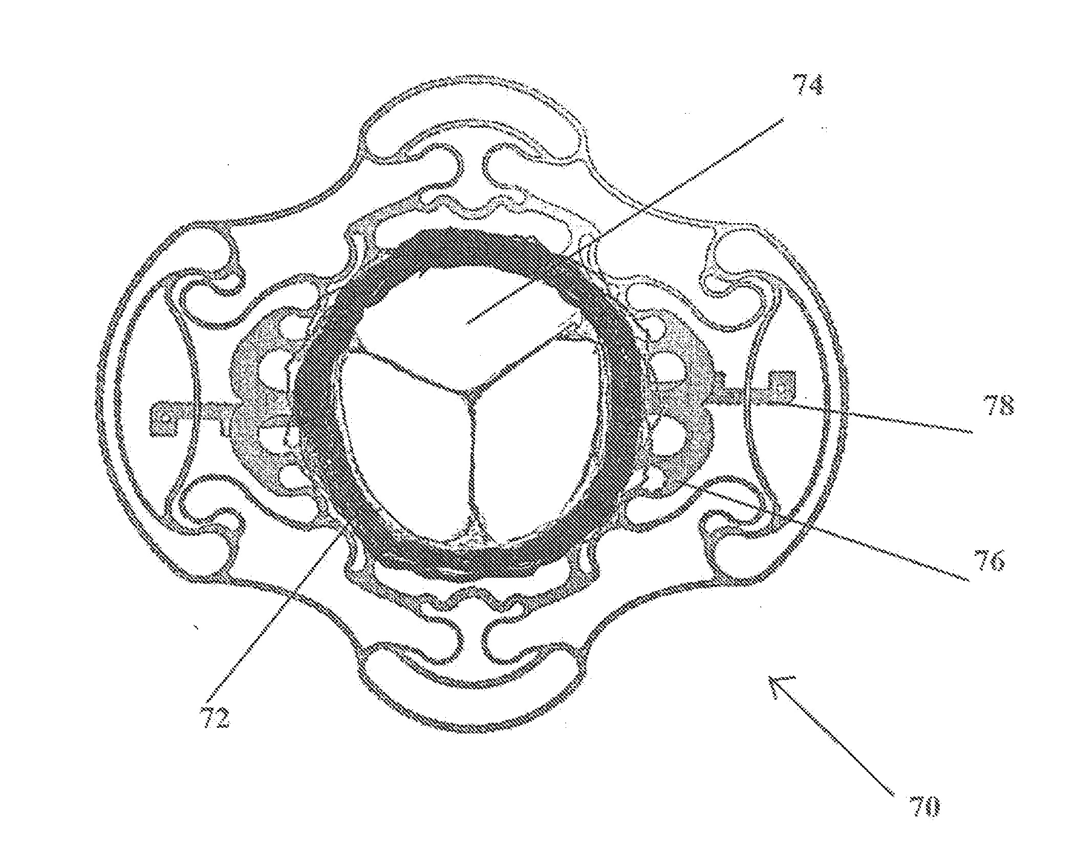 Cardiac valve support device fitted with valve leaflets