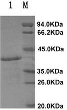 Cryptosporidium parvum immune colloidal gold detection test paper strip and production method thereof