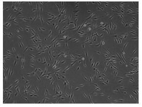 Adipsin gene modified adipose-derived stem cells as well as preparation method and application thereof