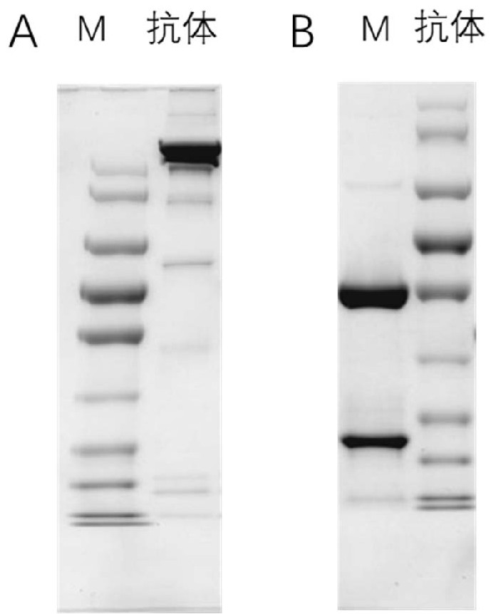 Antibody targeting influenza A virus N1 subtype NA protein