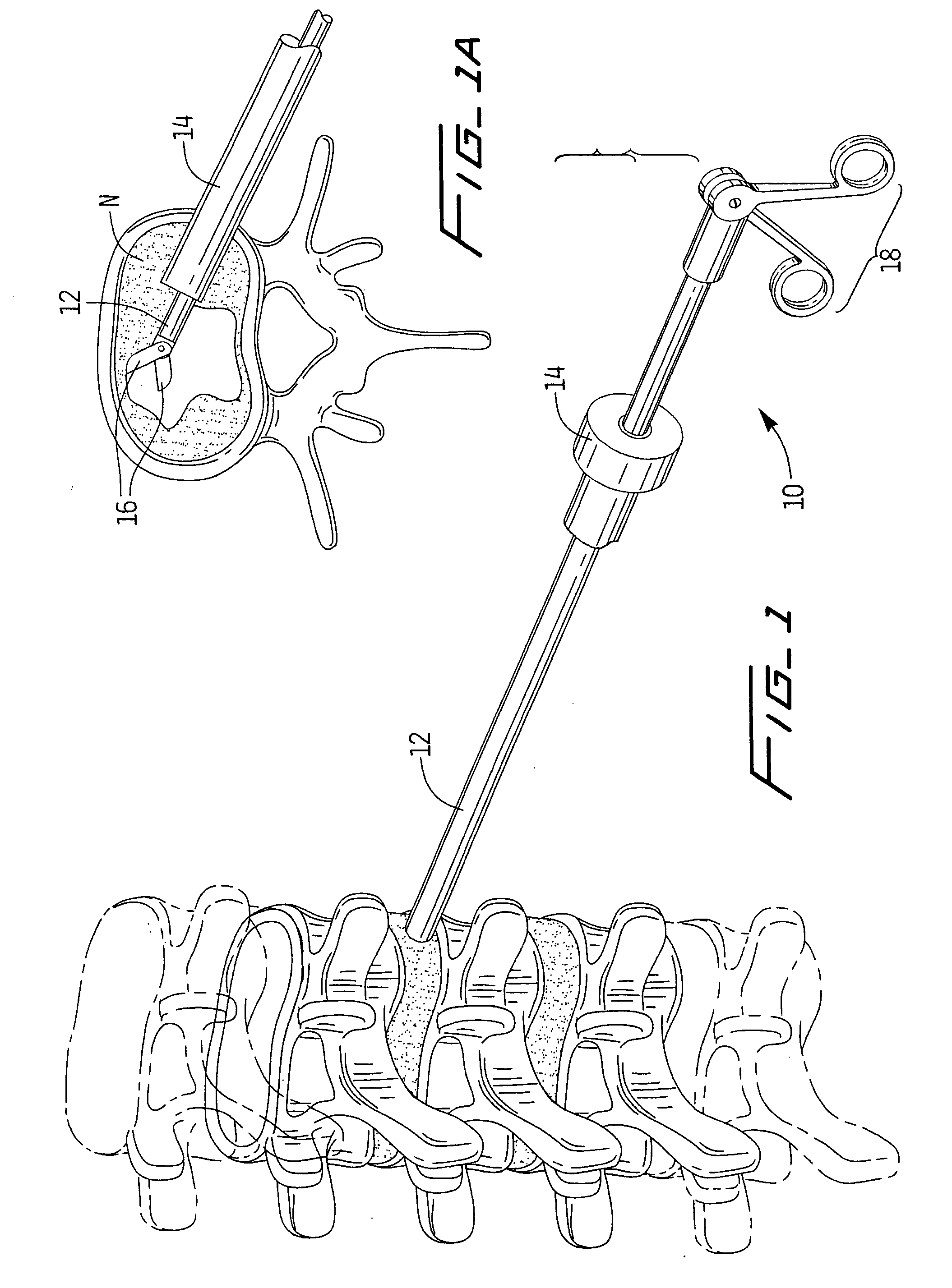 Spinal implant and method of use