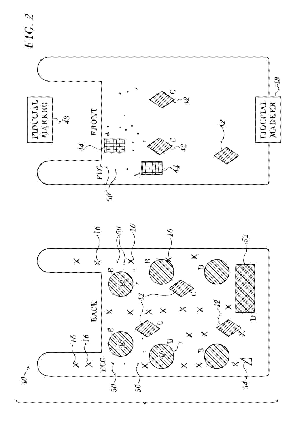 Combination torso vest to map cardiac electrophysiology