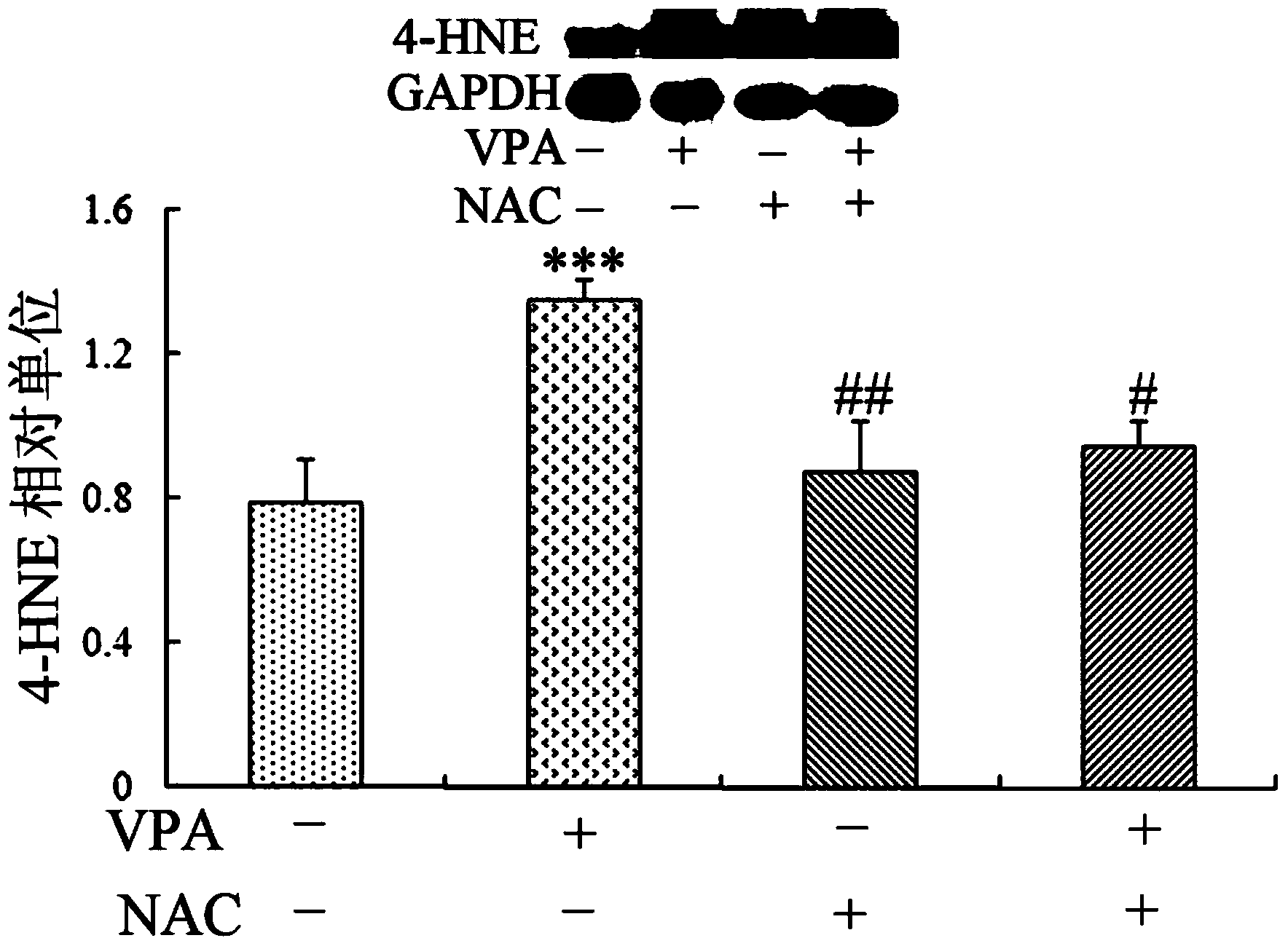 Application of sulindac in preparation of medicine for treating autism