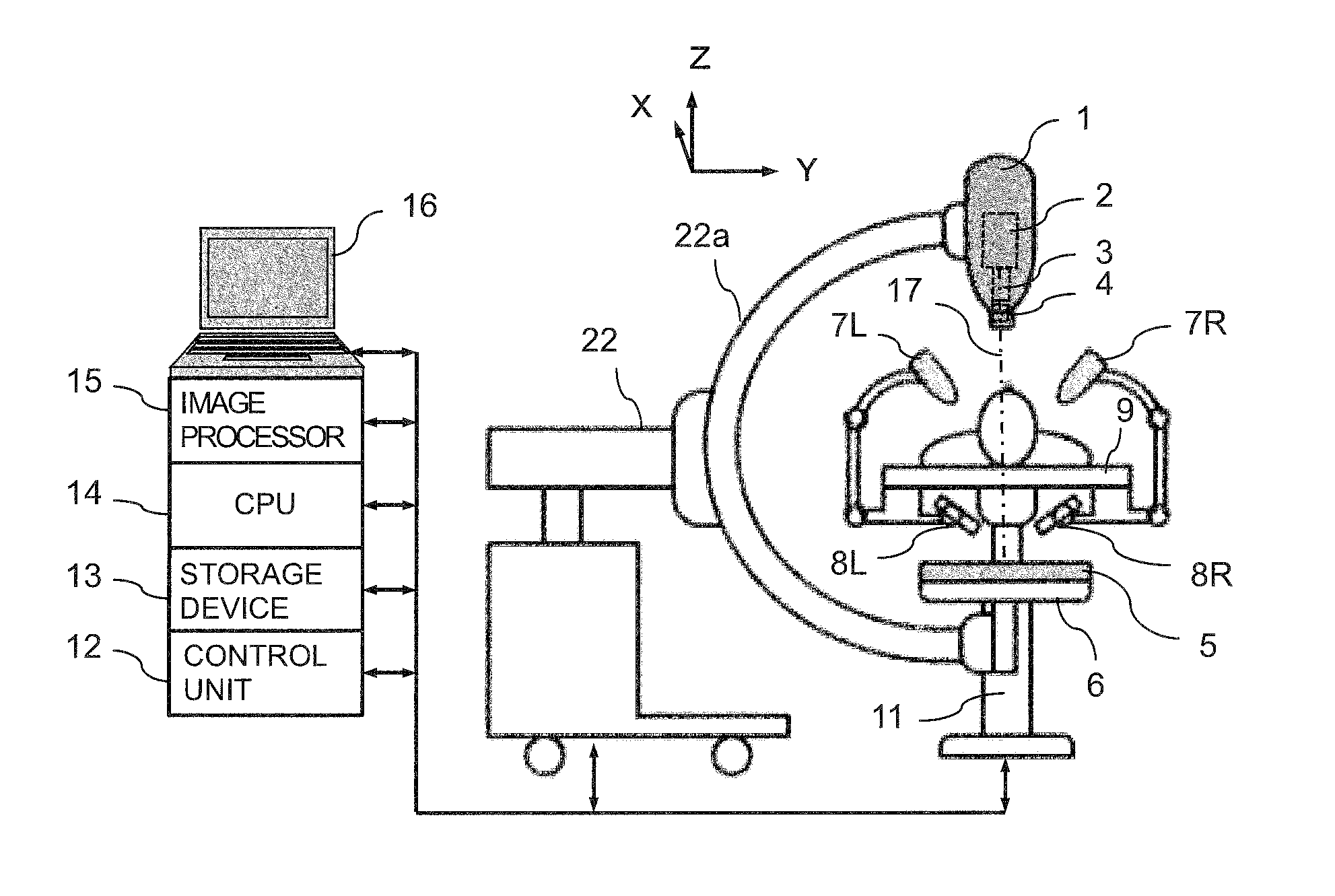 Real-Time Three-Dimensional Radiation Therapy Apparatus and Method