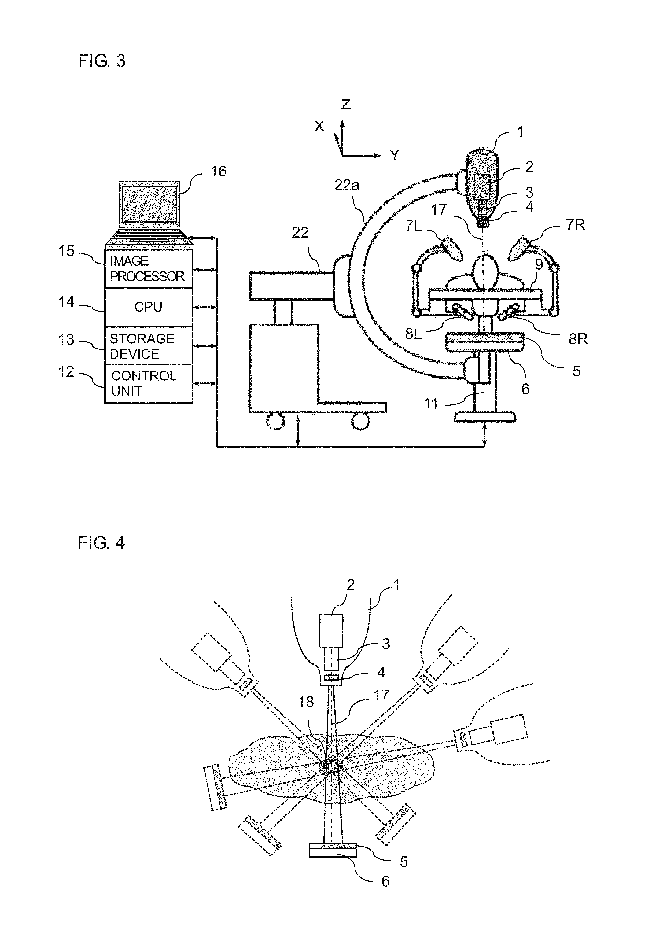 Real-Time Three-Dimensional Radiation Therapy Apparatus and Method