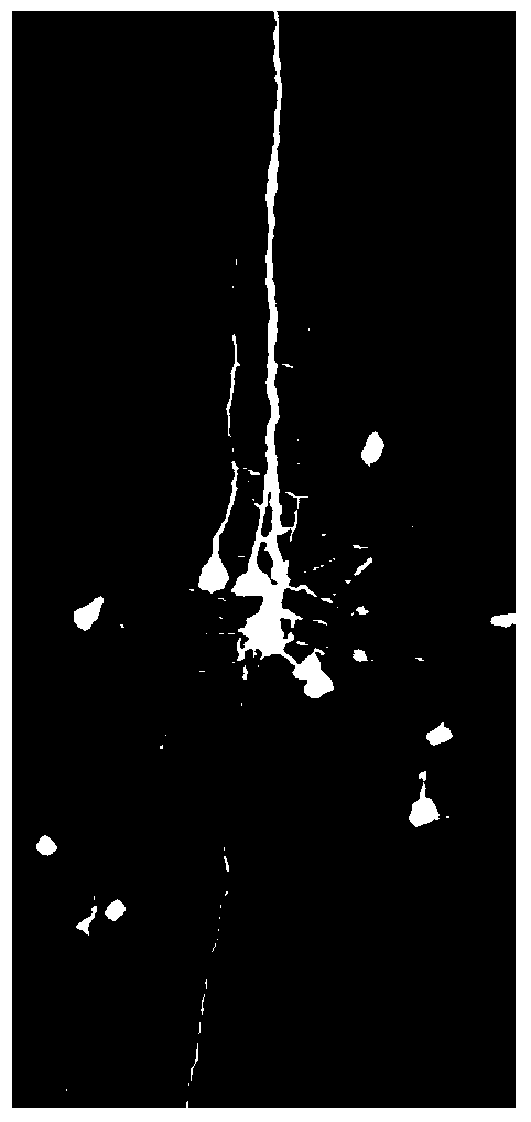 Weak background fluorescence type resin embedding method