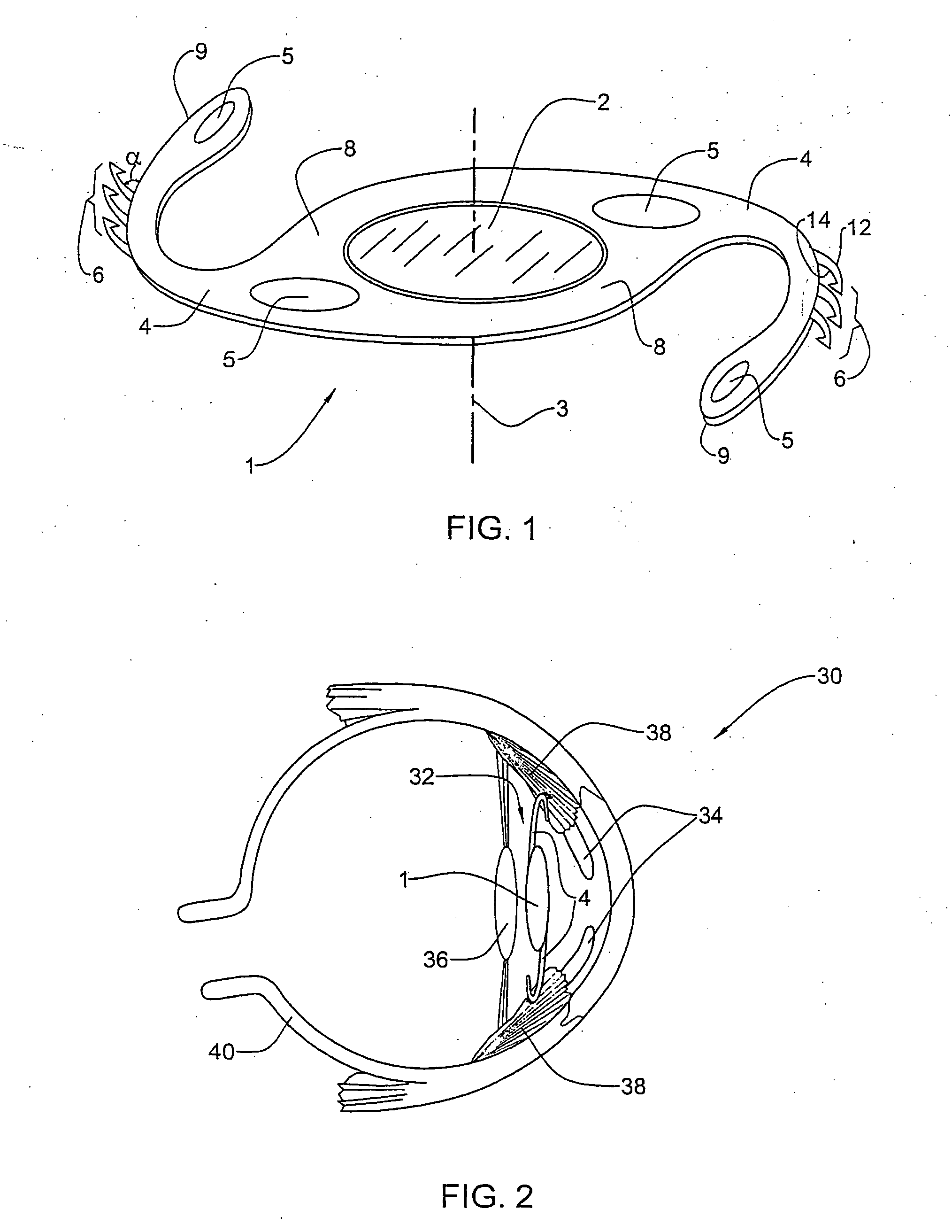 Intraocular lens