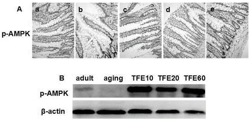 Application of epimedium total flavone in intervention of intestinal tract barrier dysfunction