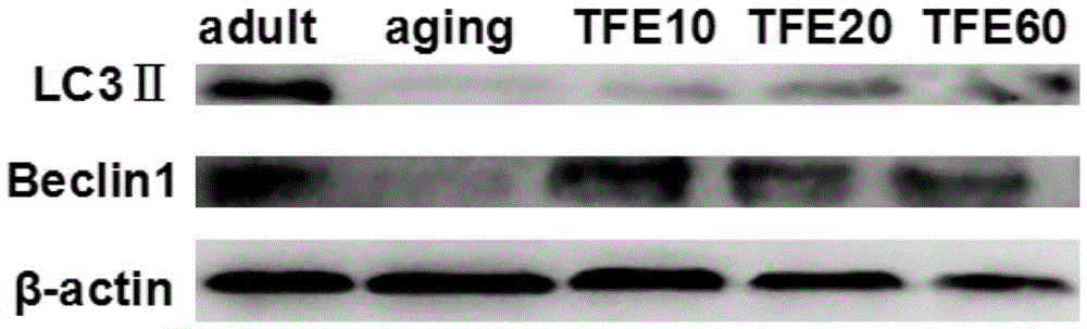 Application of epimedium total flavone in intervention of intestinal tract barrier dysfunction