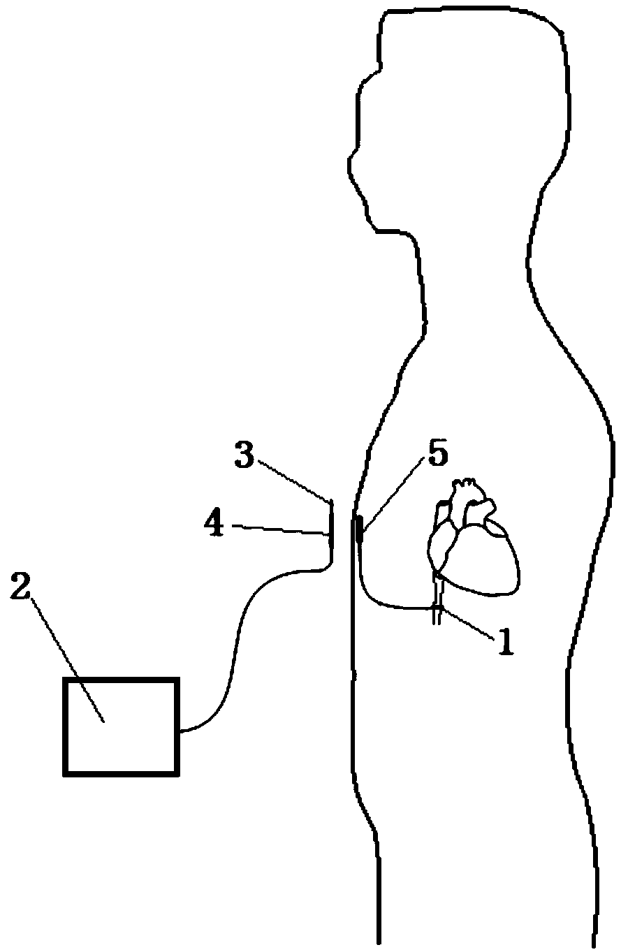 Multi-receiving-terminal wireless electric energy transmission device used for assisting blood supply and provided with repeating coil