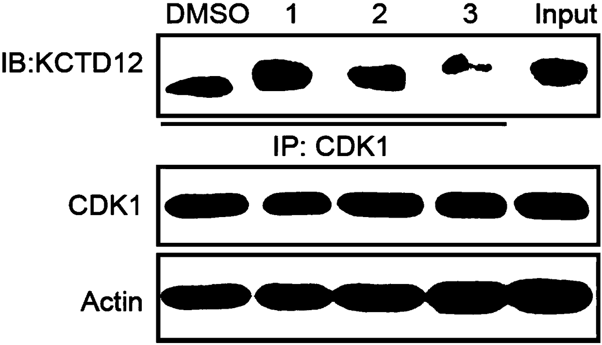 Application of adefovir dipivoxil in preparing antitumor drugs