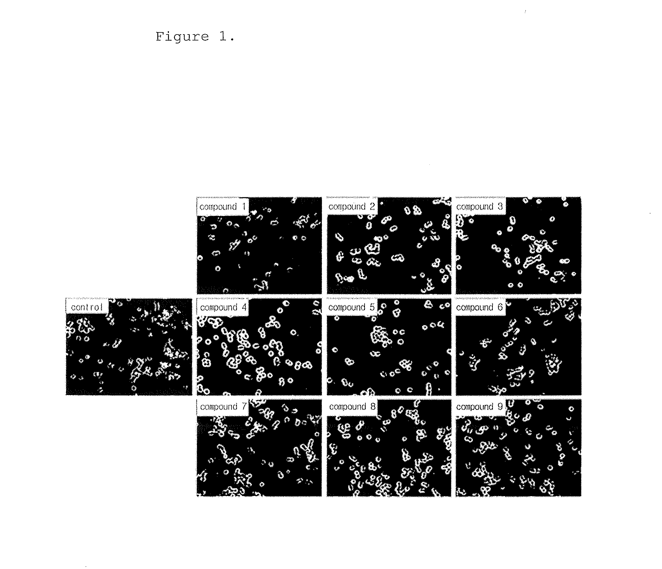 Novel biphenyl derivative or pharmaceutically acceptable salt thereof, and pharmaceutical composition for preventing or treating inflammatory diseases or autoimmune diseases comprising the same as active ingredient