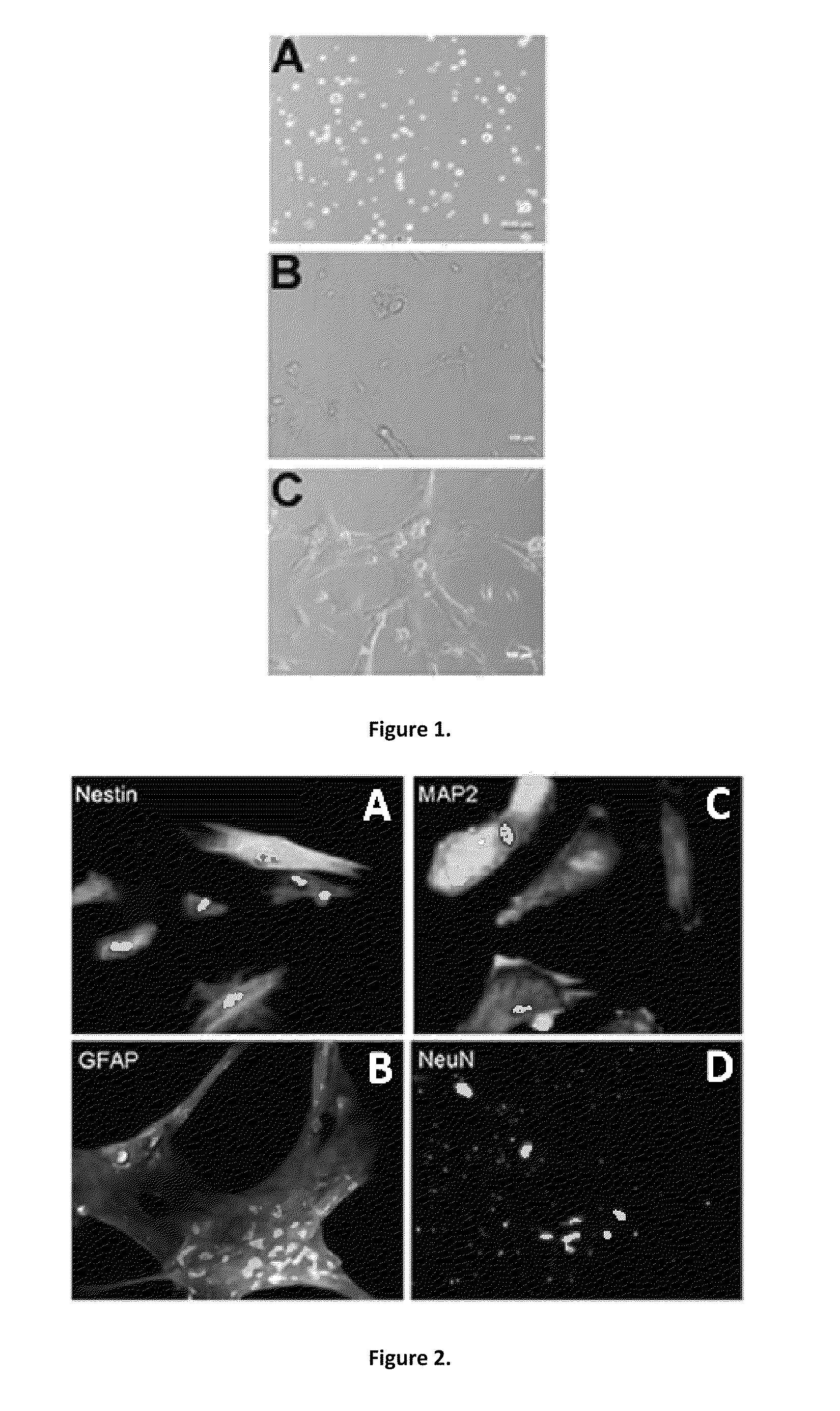 Methods of treating stroke using stem cell-like menstrual blood cells