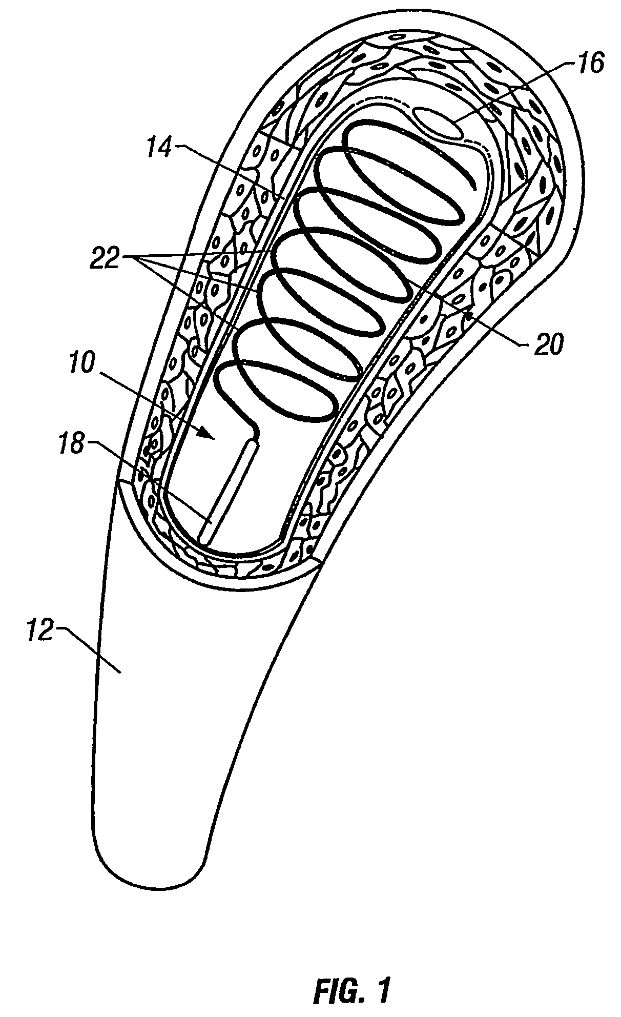 Methods and apparatus for cryo-therapy