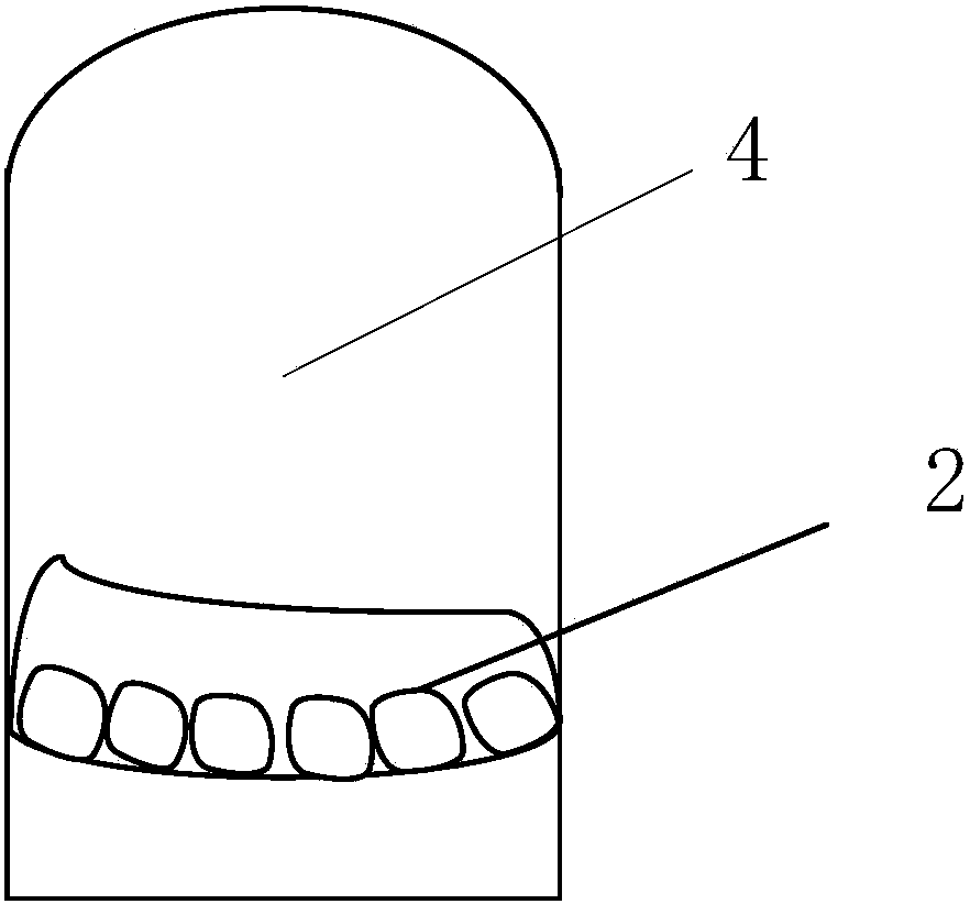 Vertically-separated support for oral cavity radiotherapy and manufacturing method thereof