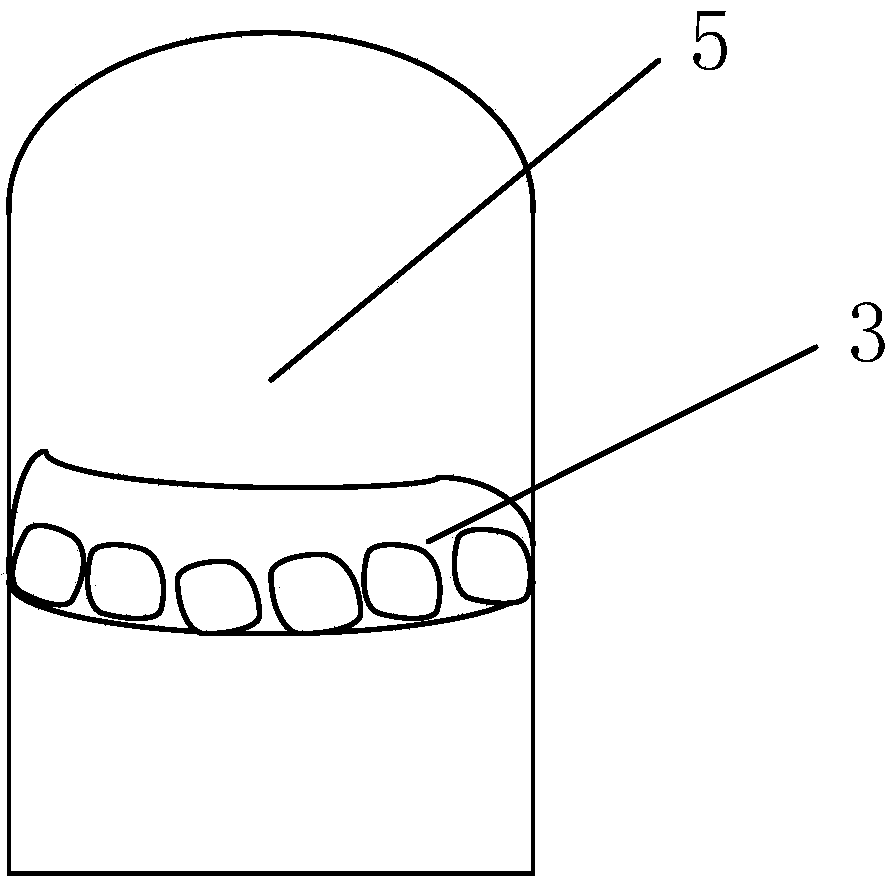 Vertically-separated support for oral cavity radiotherapy and manufacturing method thereof