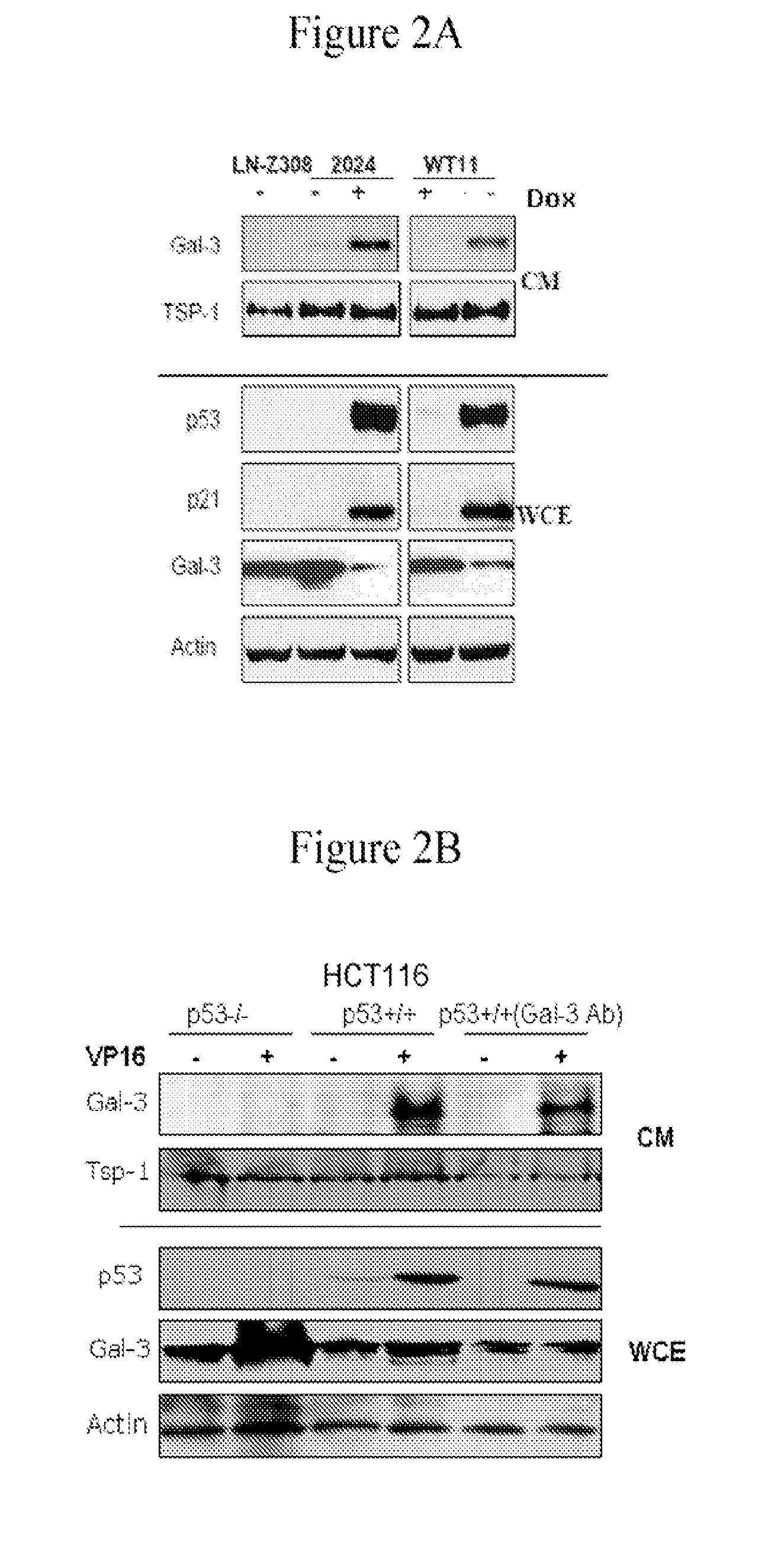 Use of Soluble Galectin-3 (Gal-3) for Cancer Treatment