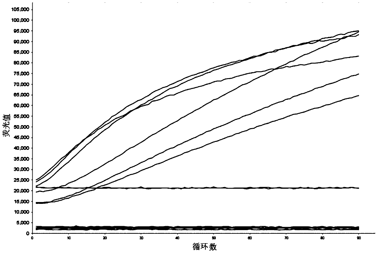 Method for detecting Mycobacterium tuberculosis from sputum