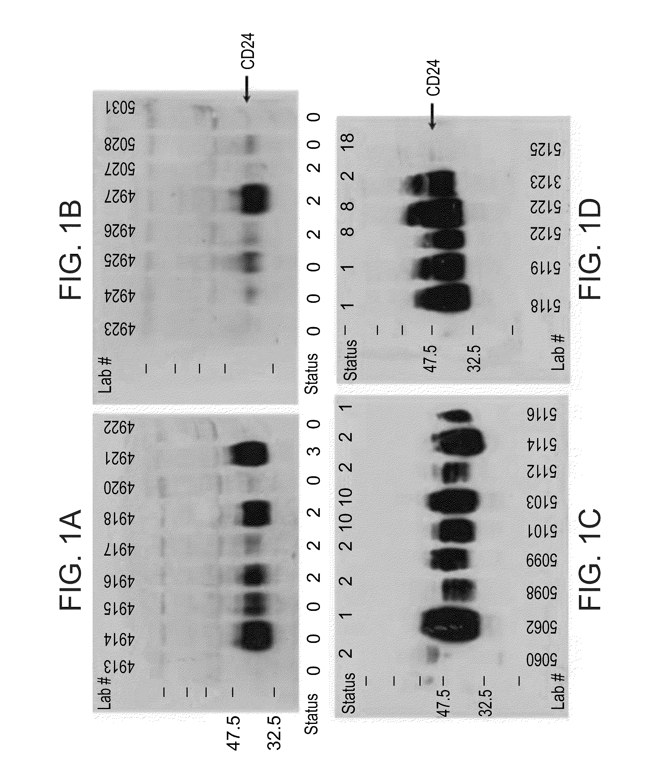 Methods of diagnosing cancer