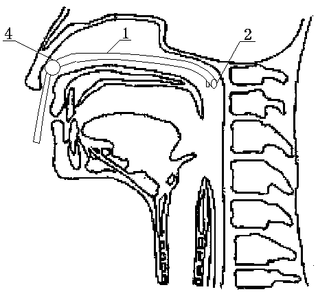 Posterior naris oxygen inhalation tube