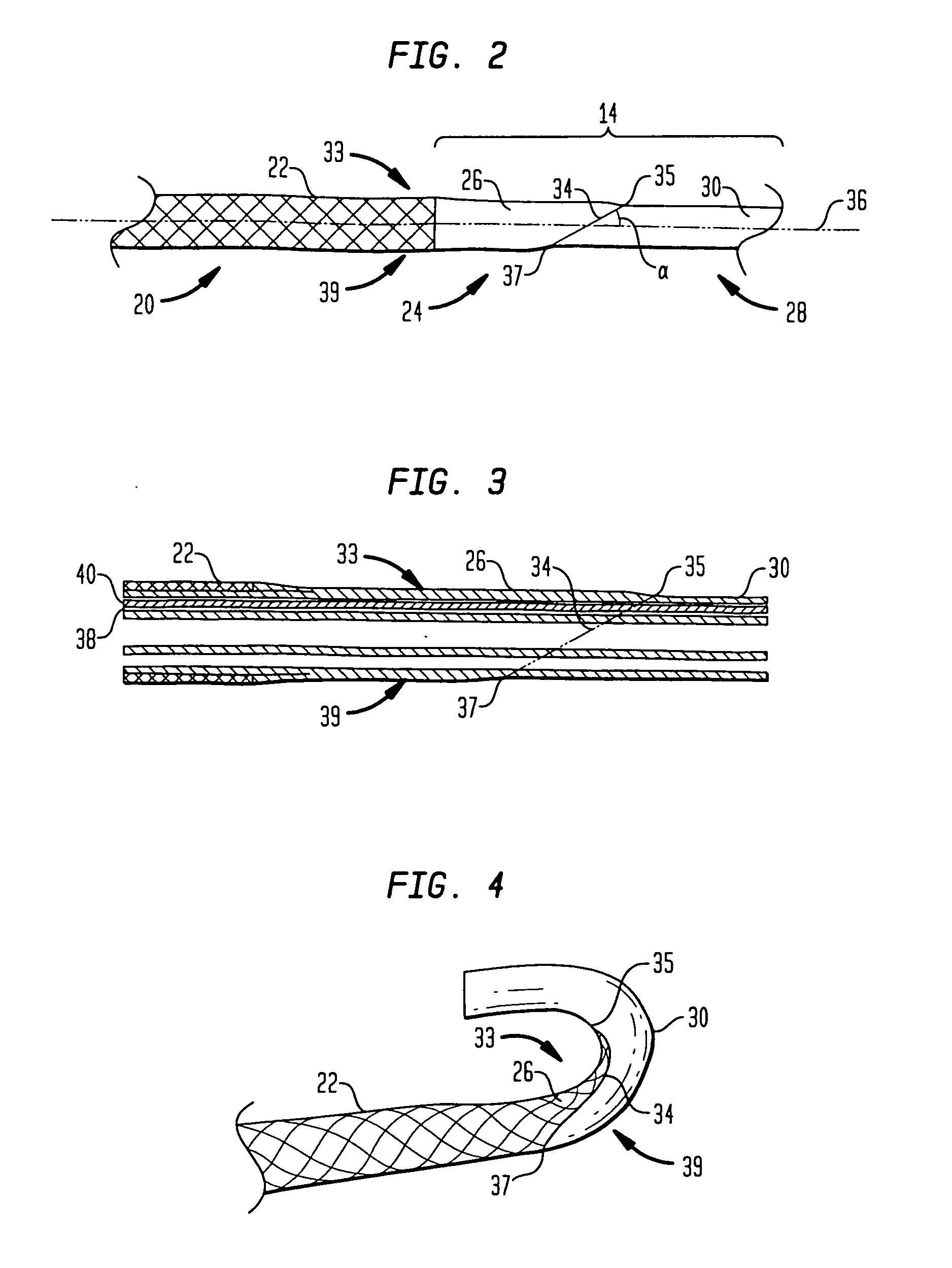 Steerable catheter