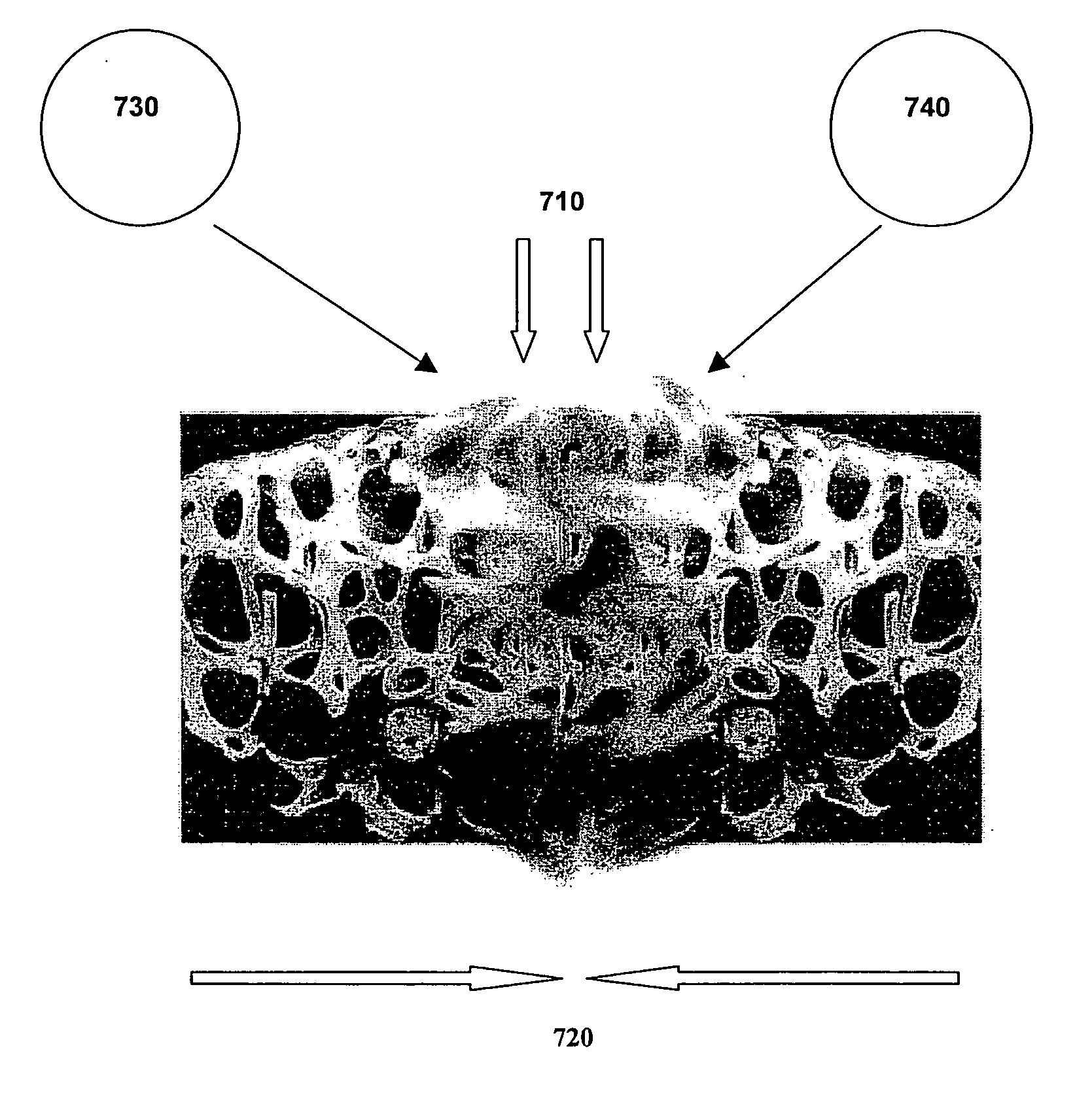 Methods and compositions for fusing bone during endoscopy procedures