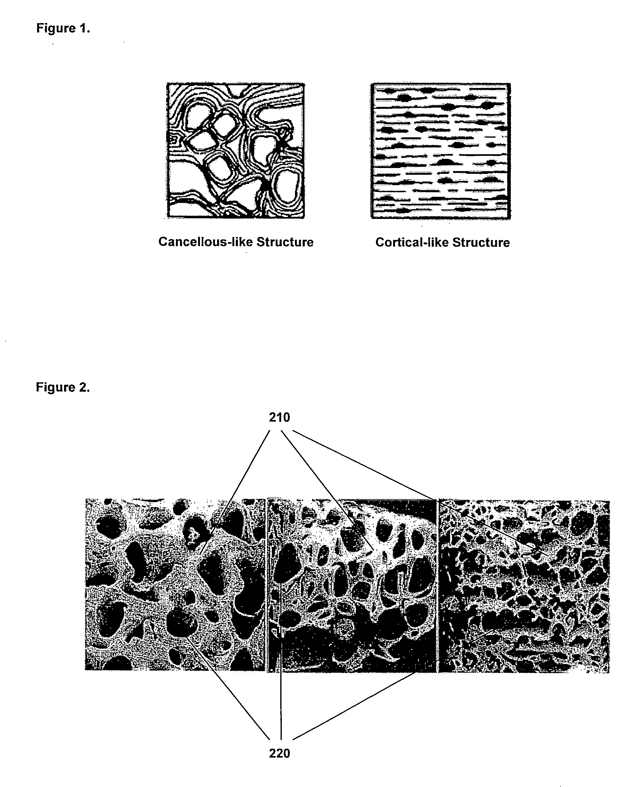 Methods and compositions for fusing bone during endoscopy procedures