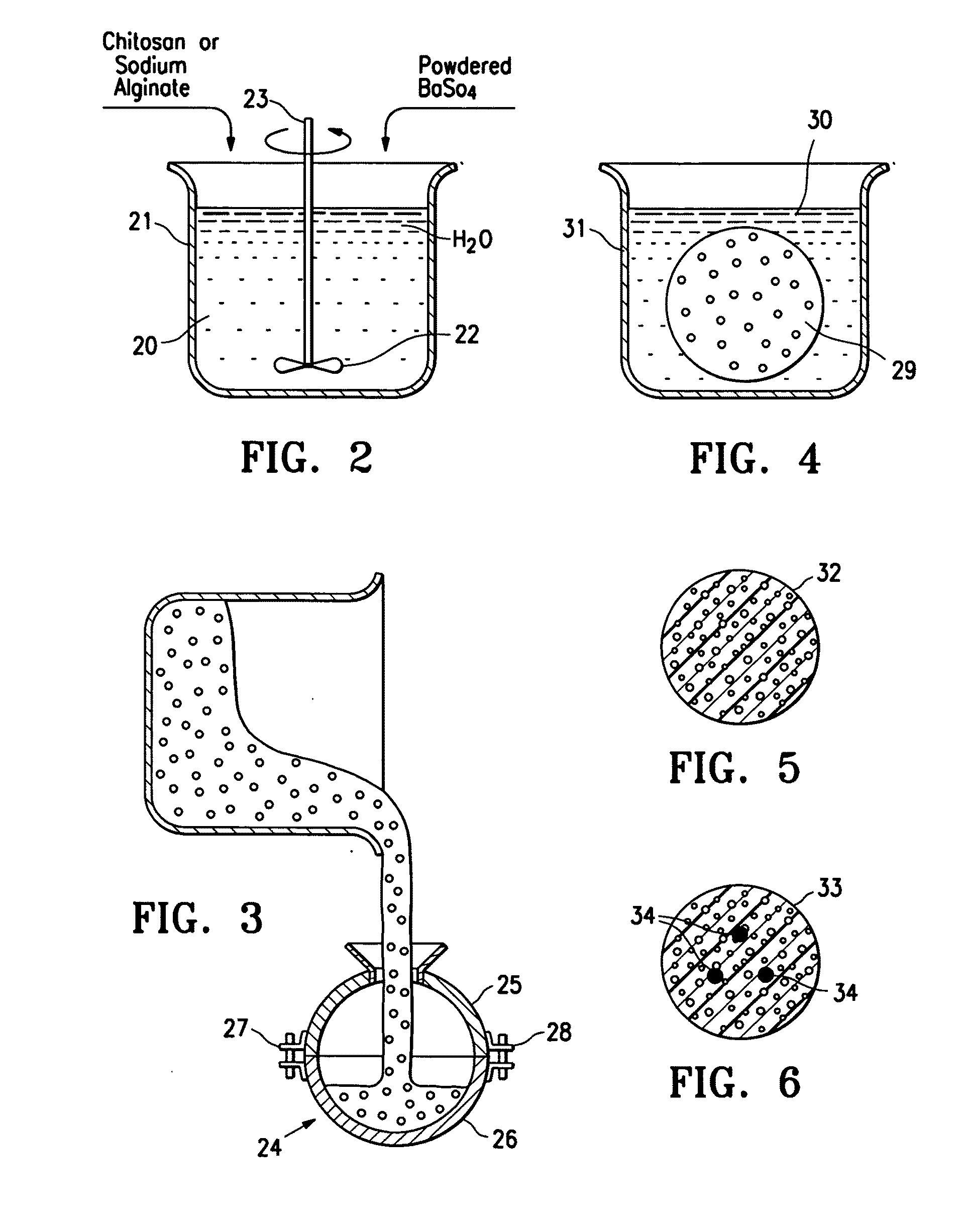 Porous bioabsorbable implant