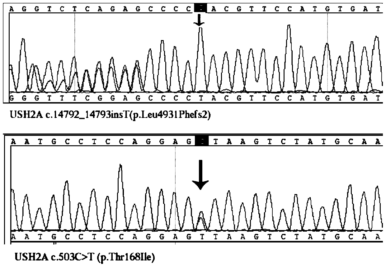 Retinitis pigmentosa mutant site and application thereof