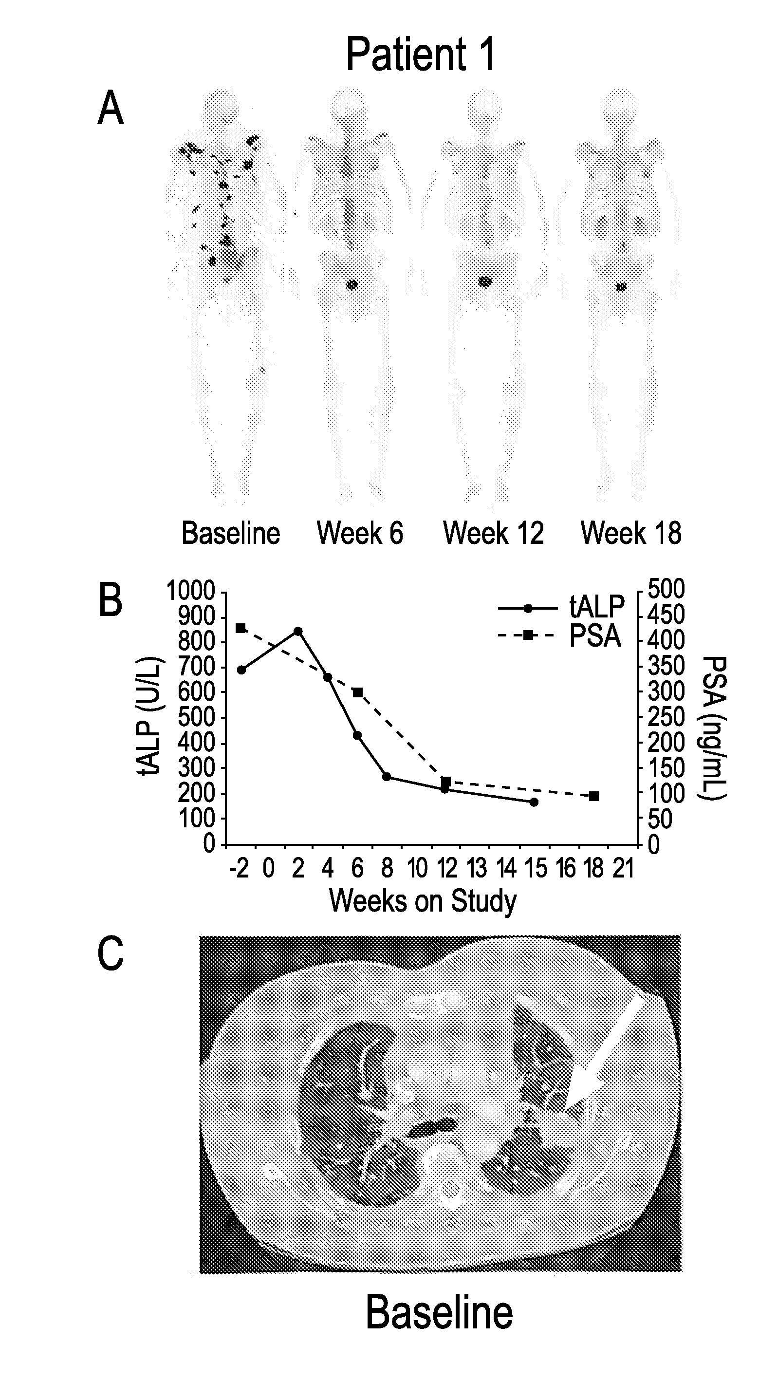 Method of Treating Cancer