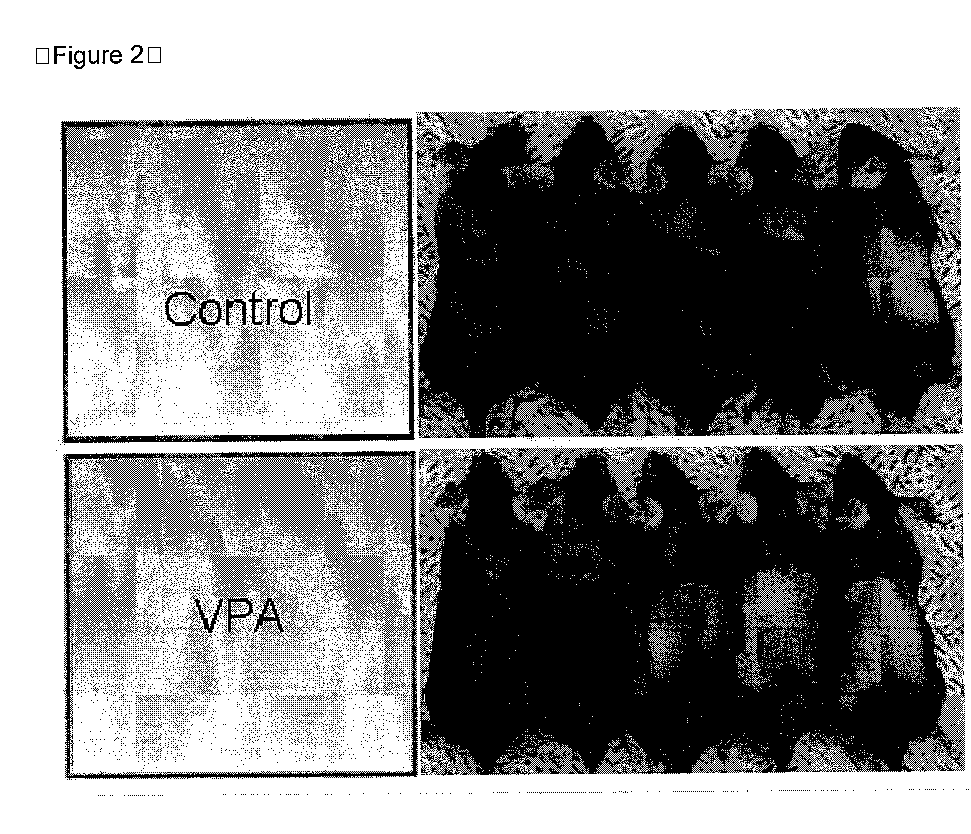 Composition for preventing hair loss or for stimulating hair growth